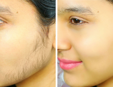 Body-care Treatments before & after-1