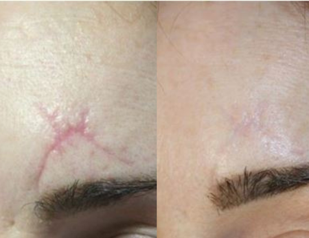 Clinical Dermatology before & after-1