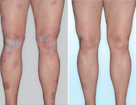 Clinical Dermatology before & after-2