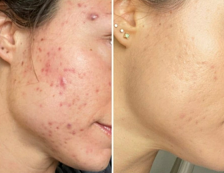 Clinical Dermatology before & after-3