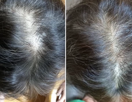 Hair Treatments before & after-2