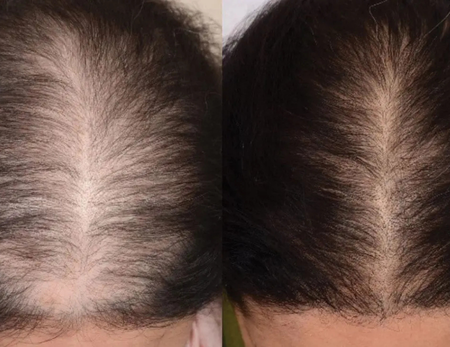 Hair Treatments before & after-3