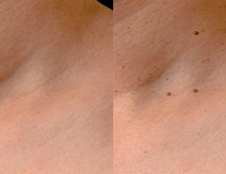 skin before & after-1