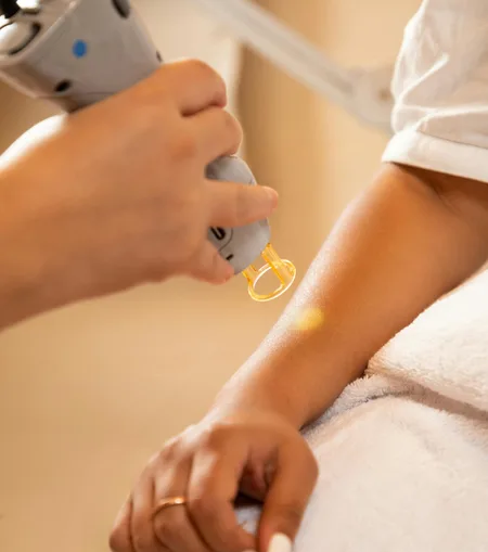 Body skin treatment performed by a dermatologist