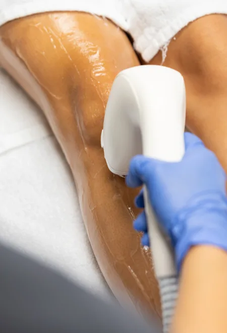 Advanced body care treatments at Soma Hair and Skin Clinic