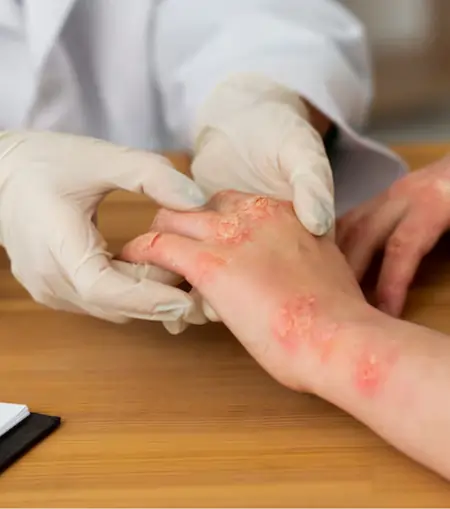 Soma's skin doctor explain abouy client skin care and treatment