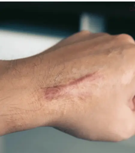 Soma's skin doctor explain abouy client skin care and treatment