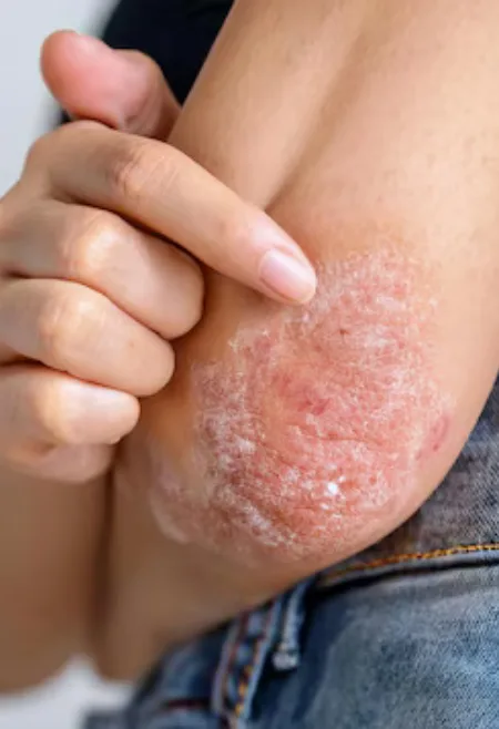 Clinical Dermatology body care treatment in soma's clinic