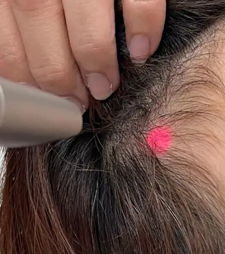 Dr Somas best hair treatments