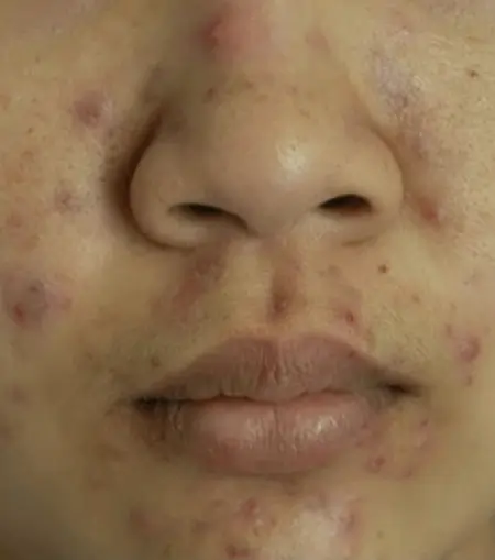 Dr Somas best skin treatments