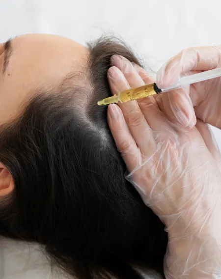 Hair treatment procedure performed by a dermatologist