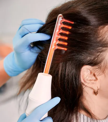 Hair loss treatment performed by a dermatologist