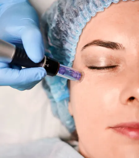 Dermatologist performing pigmentation treatment