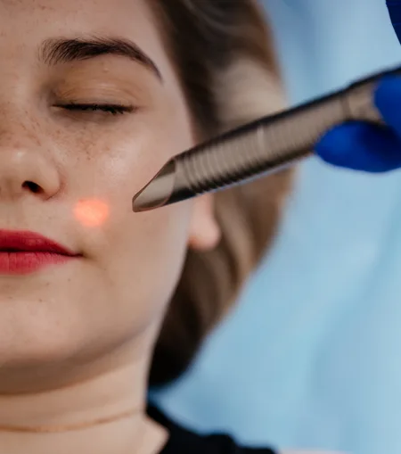 Skin brightening and pigmentation correction treatment